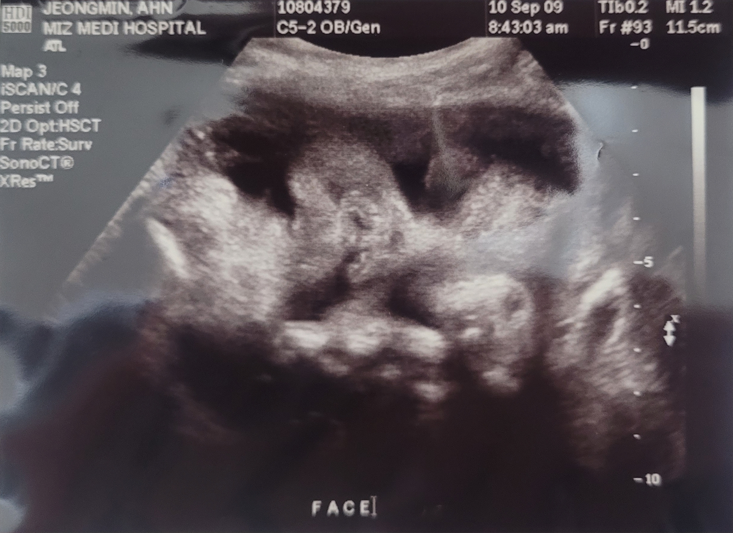 세상 나오기전 사랑하는 딸♡